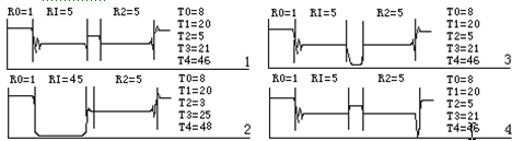 有載調(diào)壓分接開關(guān)測(cè)試儀 有載調(diào)壓分接開關(guān)測(cè)試儀